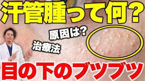 乳首に白い|乳首に白いできもの！どうして？治し方は！？ ～乳。